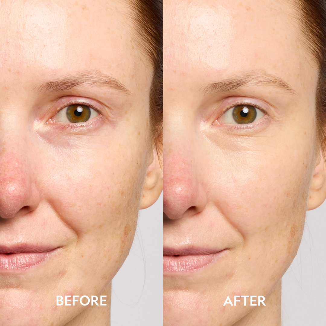 Fair shade before and after using YENSA Dark Circle Corrector