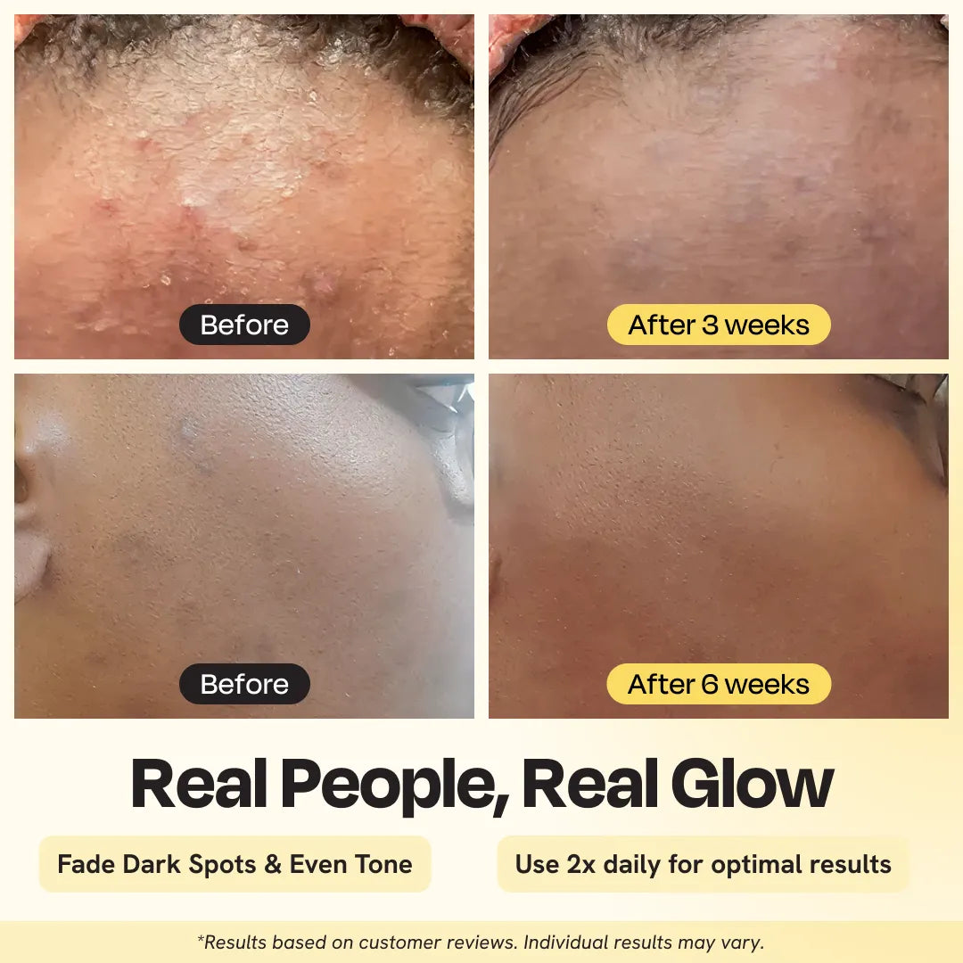 Vitamin C brightening moisturizer image 5